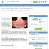 Skin and the Effects of Ultraviolet Radiation