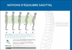 Notions d’équilibre sagittal